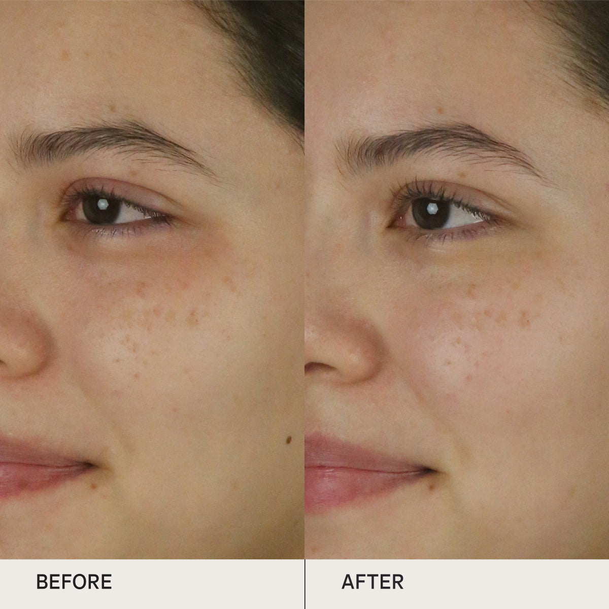 Before and after of skin using the Tatcha Dewy Milk Moisturizer for clinical tests